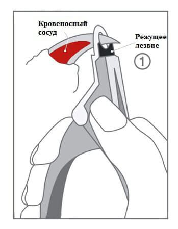 pic 12